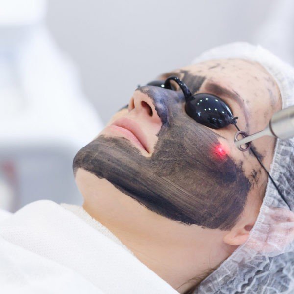 Hollywood Peel